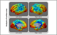 Appeared in Winkler et al. (2012), Neuroimage. [http://dx.doi.org/10.1016/j.neuroimage.2012.03.026]